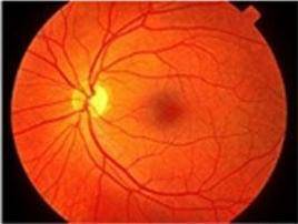 healthyretina